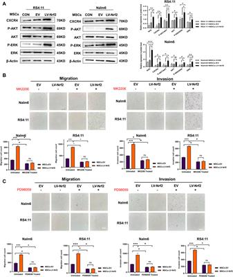 Overexpression of Nrf2 in bone marrow mesenchymal stem cells promotes B-cell acute lymphoblastic leukemia cells invasion and extramedullary organ infiltration through stimulation of the SDF-1/CXCR4 axis